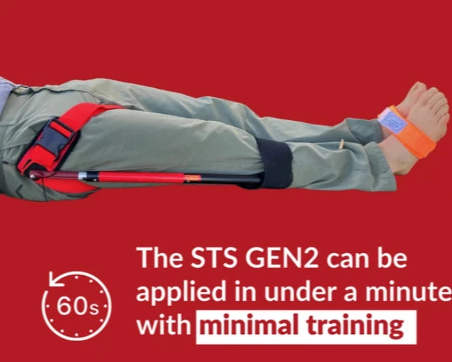 Adult application of Slishman Gen 2 Traction Splint can be applied quickly with minimal training.