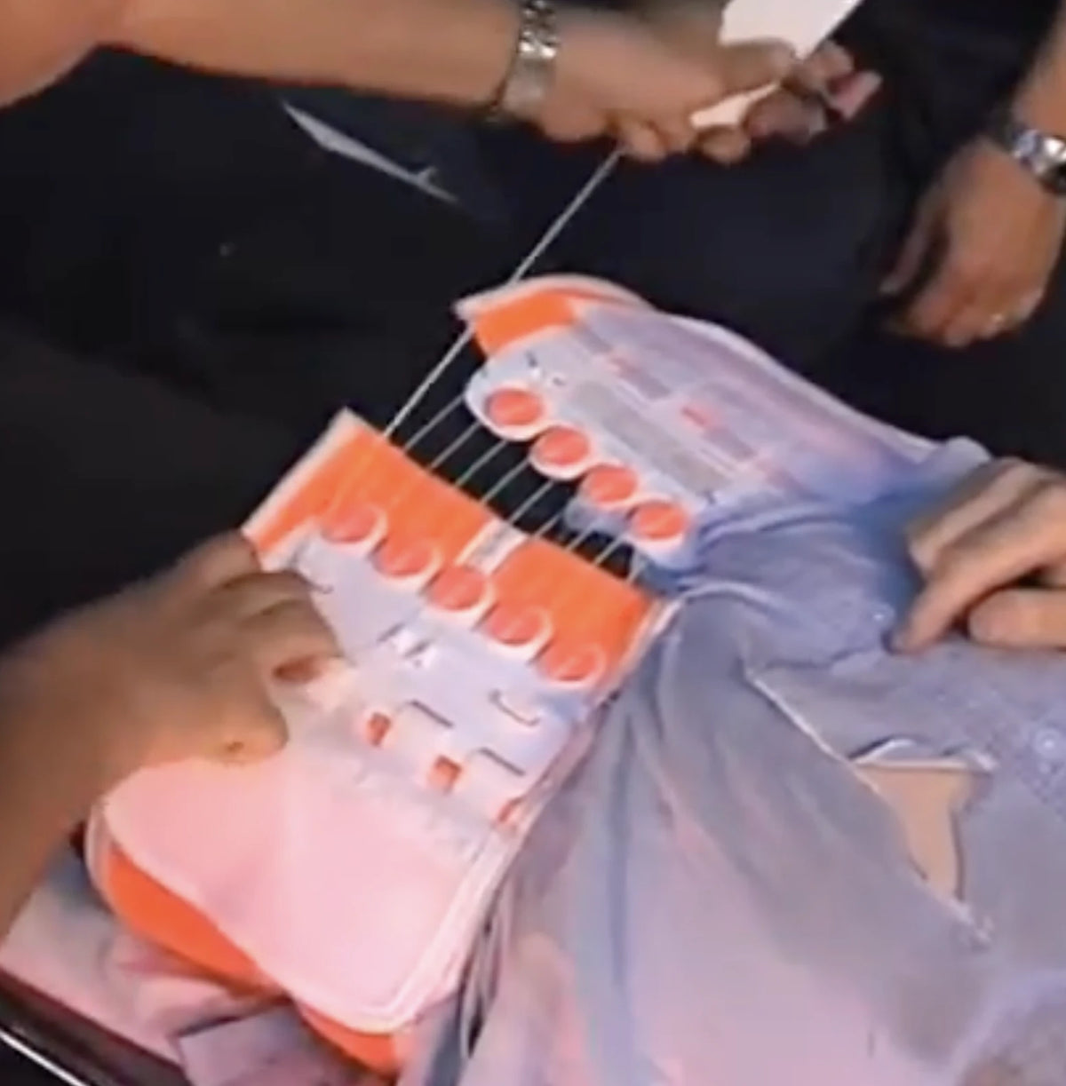 Picture of a TPOD pelvic stabilization device being tightened.