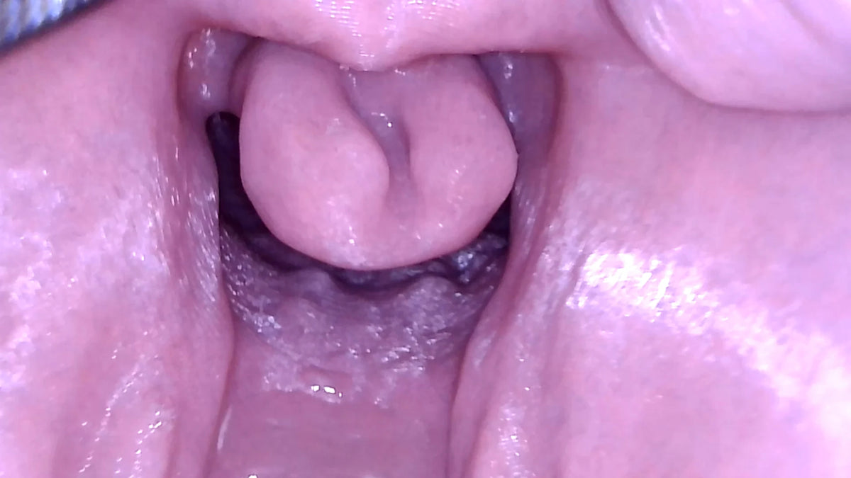 Close view of the enlarged epiglottis in the Decent V2 epiglottitis airway insert