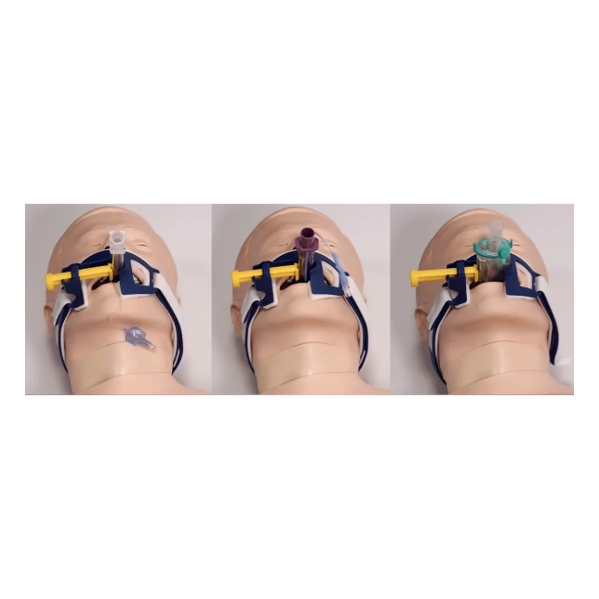 Laerdal Thomas Select tube holder 600-42500 securing an endotracheal tube, a second airway, and an i-gel supraglottic airway - Pacific Biomedical