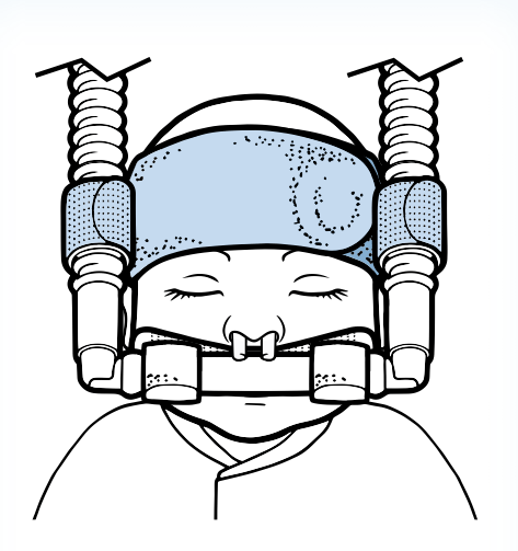 Neonatal CPAP Circuits & Accessories - Pacific Biomedical