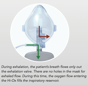 V Mask Fio2 Hi-Ox High-FiO2 Oxygen Mask, Adult Small