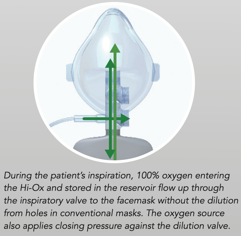 Mask Fi02 Hi-Ox High-FiO2 Oxygen Mask, Adult Small