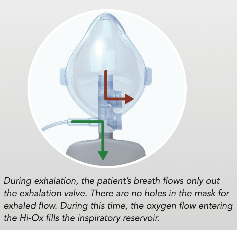 Fio2 Sengan Simple Mask Hi-Ox High-FiO2 Sequential Dilution Oxygen Mask