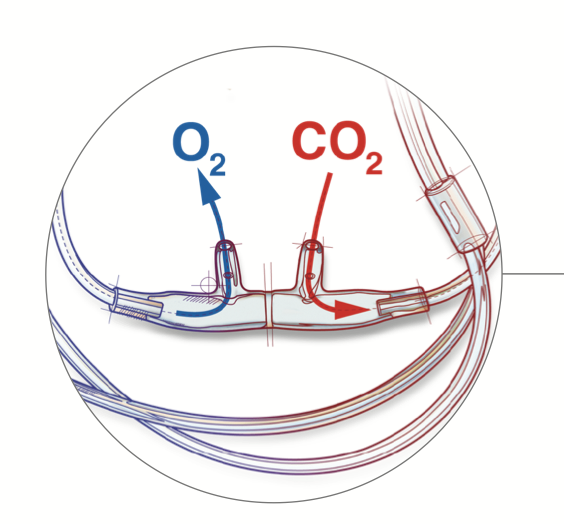 Airlife ETCO2 with Split Cannula design delivering oxygen in one nostril and monitoring ETCO2 in the opposite nostril.