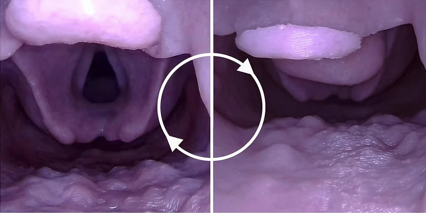 V2 Airway Trainer mass and tumor insert P0090 for the Decent C0010 difficult airway scenario rotation. Pictured, right is an airway mass for the Decent Simulator Airway Manikin V2. On the left is the standard airway insert. PN:P0090