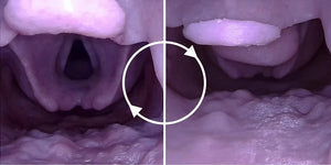 V2 Airway Trainer mass and tumor insert P0090 for the Decent C0010 difficult airway scenario rotation. Pictured, right is an airway mass for the Decent Simulator Airway Manikin V2. On the left is the standard airway insert. PN:P0090