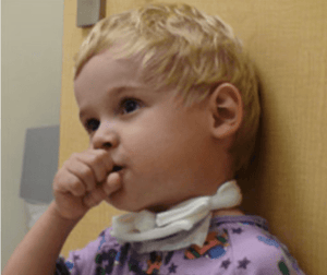 Cute kid with a Danny tie securing a trach.