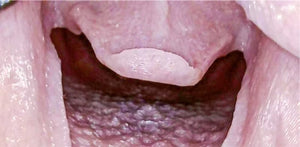 High Fidelity Standard Airway for the Decent Simulator V2 Adult Simulator

