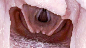Picture of glottic opening on a Adult Decent Simulator Difficult Airway Trainer