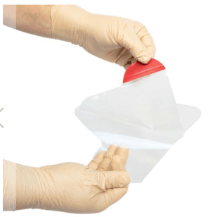 Clear Hyfin Chest Seal application, alternative to occlusive dressings.