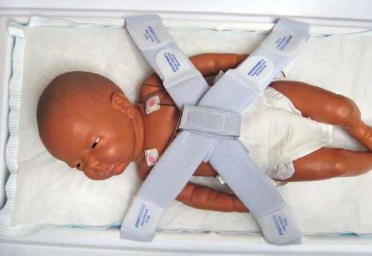 Baby secured in isolate or incubator with Statstraps from Respirlogics. Comparable to International Biomed Infant Straps.