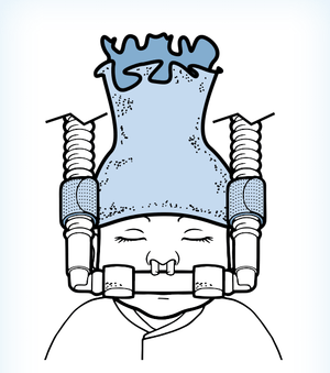 Baby Cap and Circuit Bumpers - Pacific Biomedical