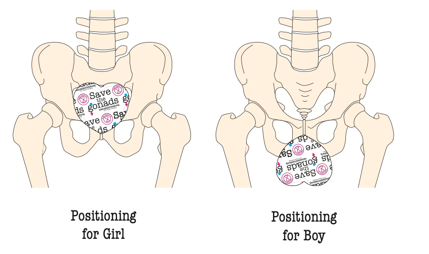 Save the Gonads™ X-ray Shields - Pacific Biomedical