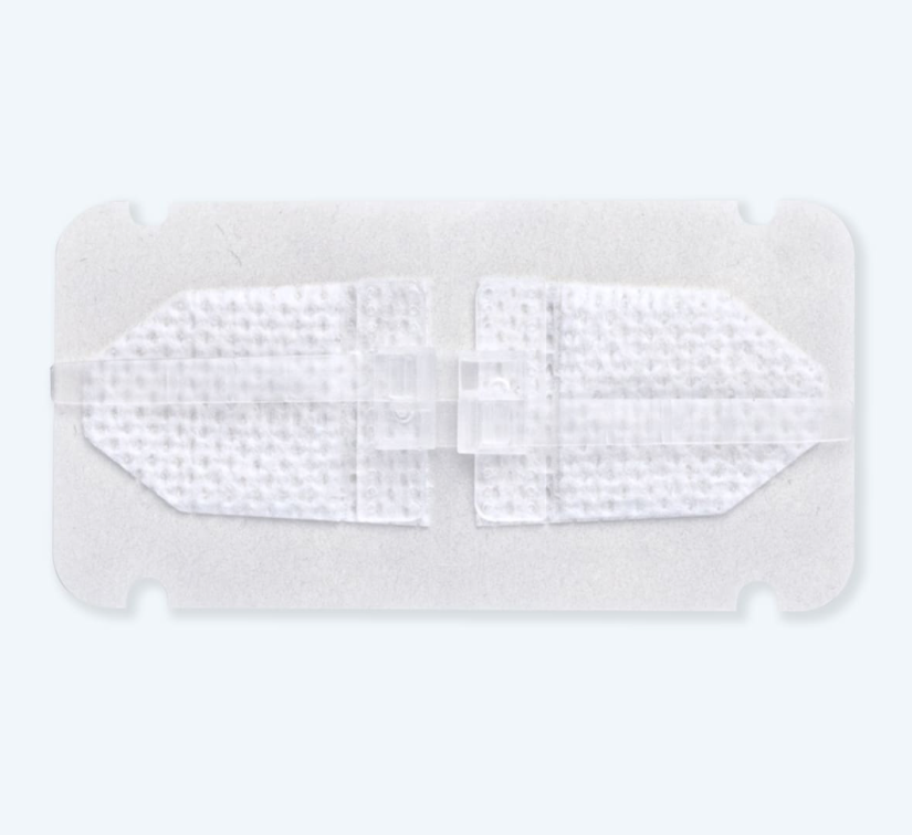 Dermaclose System Dermaclip Skin Closure Device | Pacific Biomedical