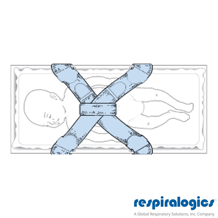 StatStrap Neonatal Positioning Strap (4 boxes of 25 sets) 