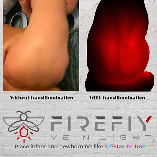 Firefly Vein Light® Model 2.0