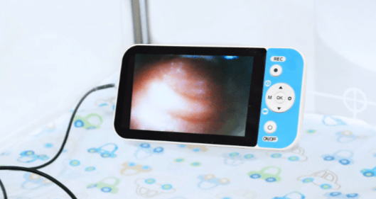 NeoView Video Laryngoscope Monitor - Pacific Biomedical