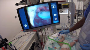 Pediatric Neonatal intubation with Airtraq A390 cam and a size 0 blade.