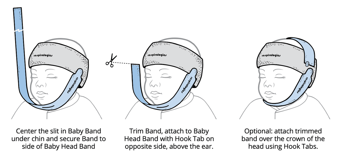 Baby Band for Chin &amp; Head - Pacific Biomedical