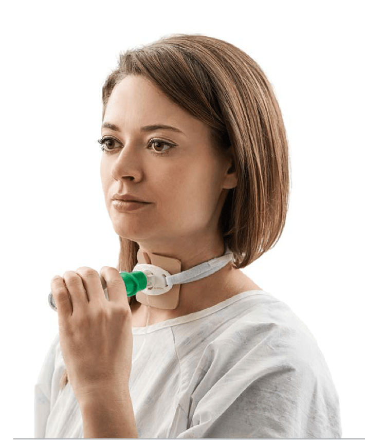 ODAPT Adapter for Soft Mist Inhaler - Pacific Biomedical