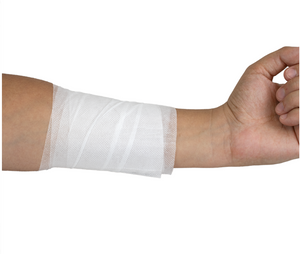 rolled gauze applied to a patients arm to dress a wound.